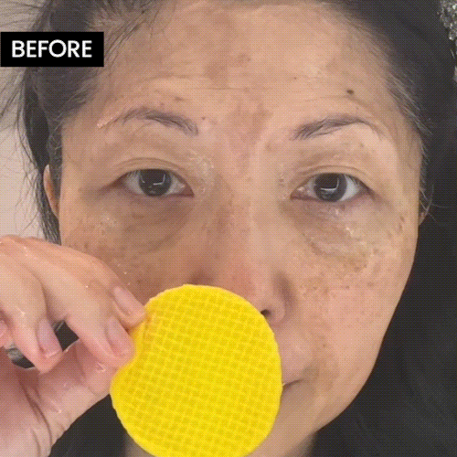 Turmeric Kojic Acid Pads