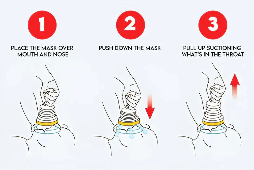LifeSaver Anti-Choking Device